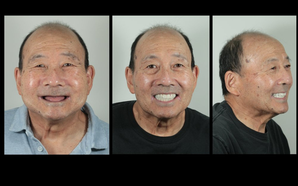 Slider image (4) Art Dental Care